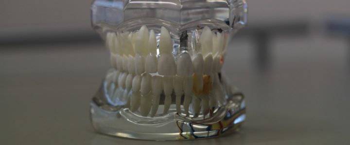 La prothèse dentaire et ses spécificités